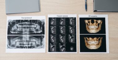 Что вы увидите, открыв диск с КТ: папки, срезы и 3D-модель
